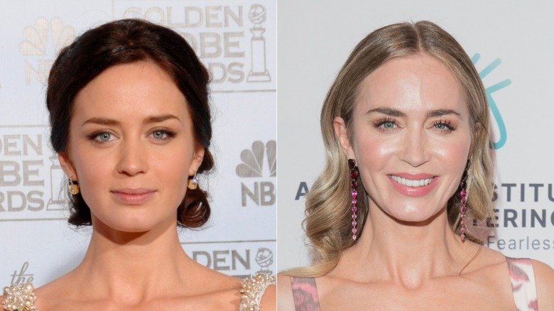 Emily Blunt Botox